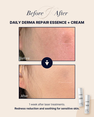 K BOOSTER DAILY DERMA REPAIR ESSENCE 50ml