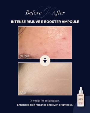 K BOOSTER INTENSE REJUVE R BOOSTER AMPOULE 30ml